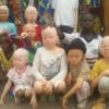 Lomami : Plus de 30 cas de femmes répudiées aux mariages parce qu’elles ont donné naissance aux albinos, renseigne la coordonnatrice de l’ASSADLO     