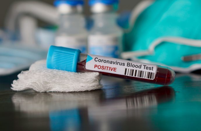 RDC-Coronavirus : les mesures restrictives seront prises à l’issue du conseil des ministres extraordinaire, annonce le porte-parole du gouvernement provincial