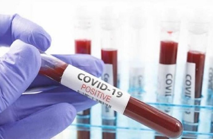 Coronavirus en RDC : 26 nouveaux cas confirmés, le cumul est de 442 cas dont 28 décès et 50 guéris